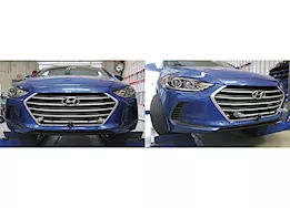 Blue Ox 17-18 elantra(excl gt/gt sport)baseplate